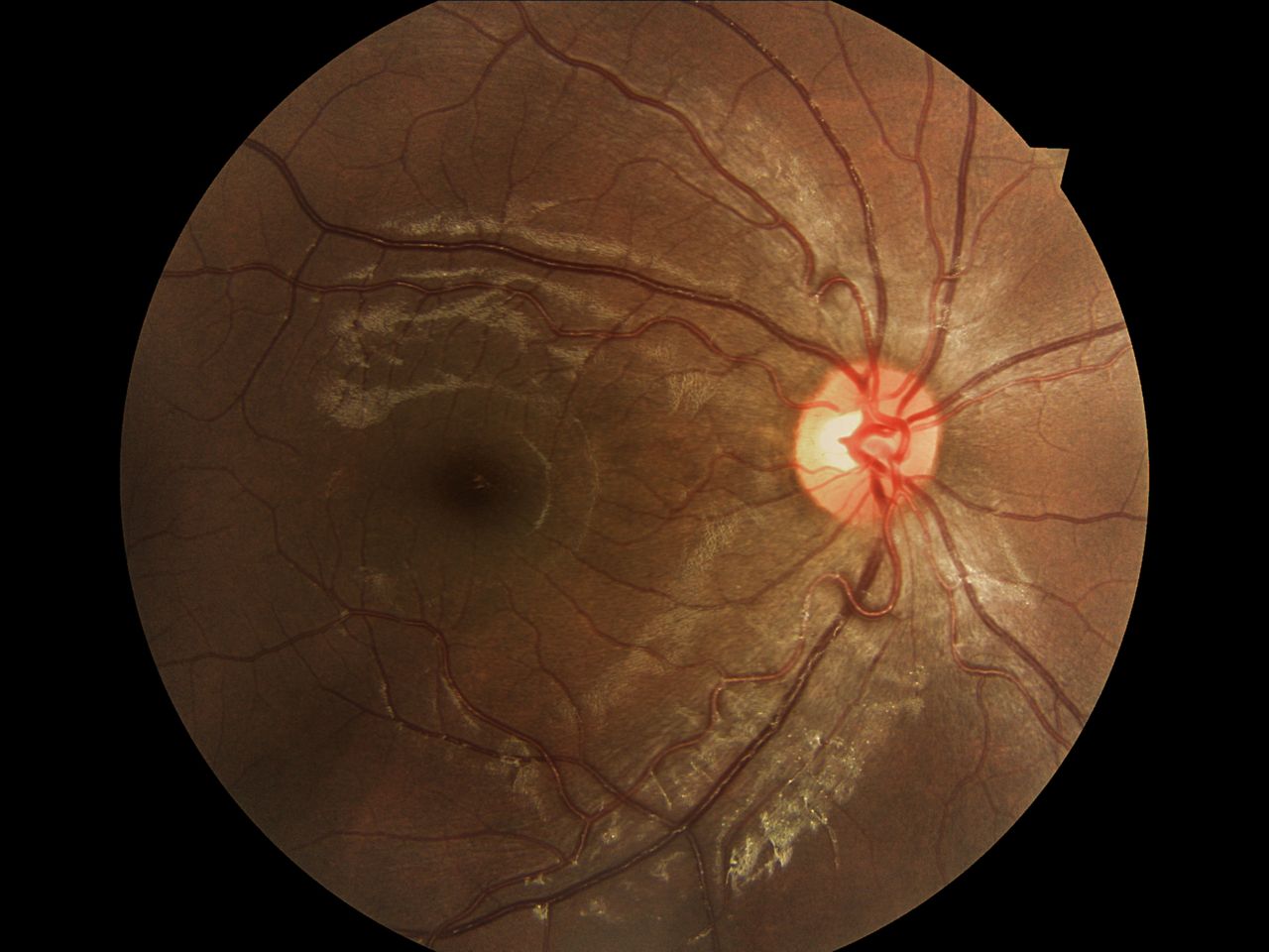 Brenda Palomares Sanchez-0