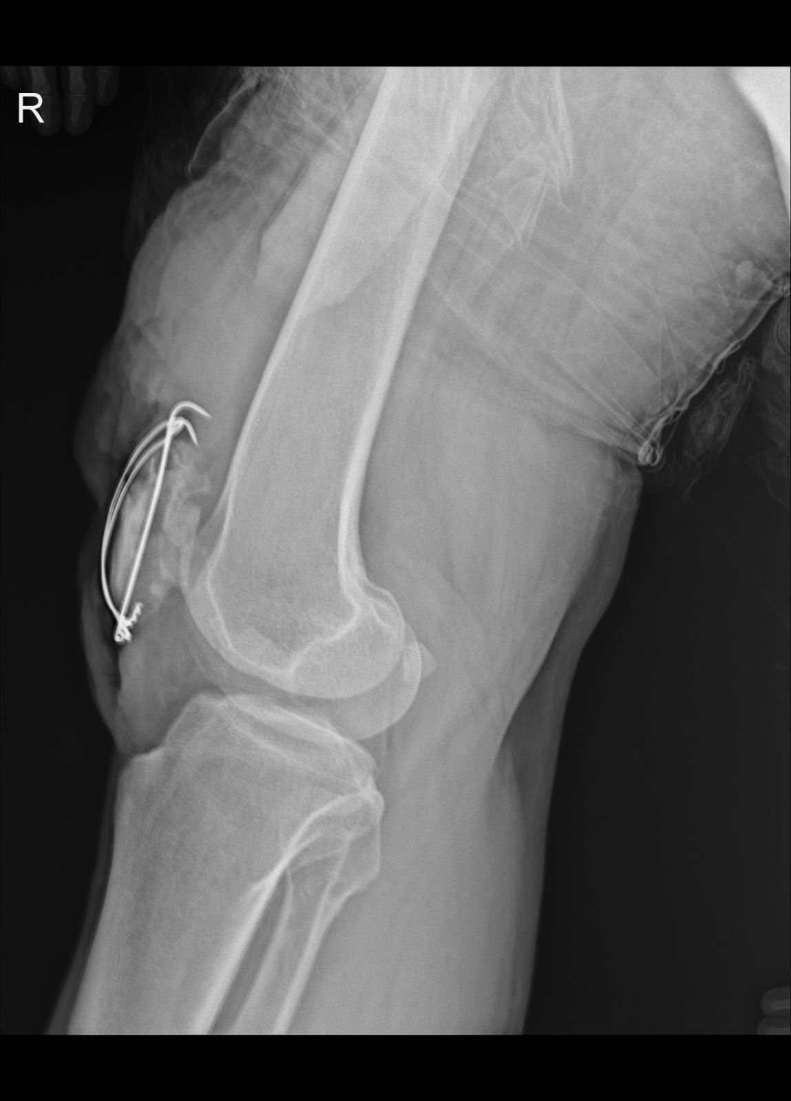 Carlos Humberto Vera Torres-9