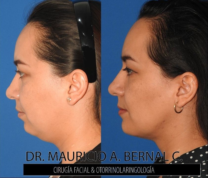 Mauricio Alejandro Bernal Carreon-11