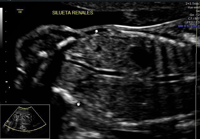 Graciela Elizabeth De La Torre Alvarez-12