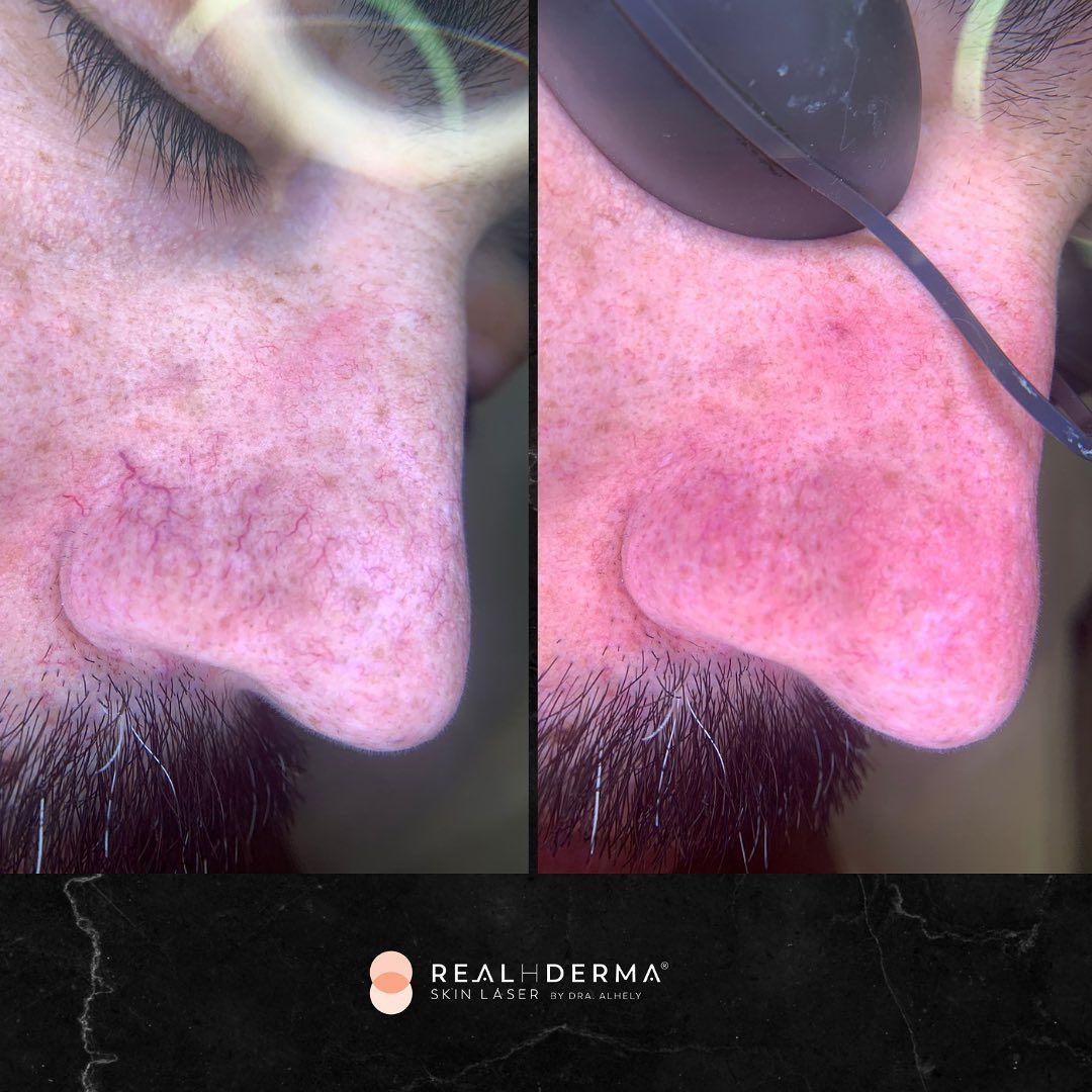 Laura Alheli Niebla Maldonado-15