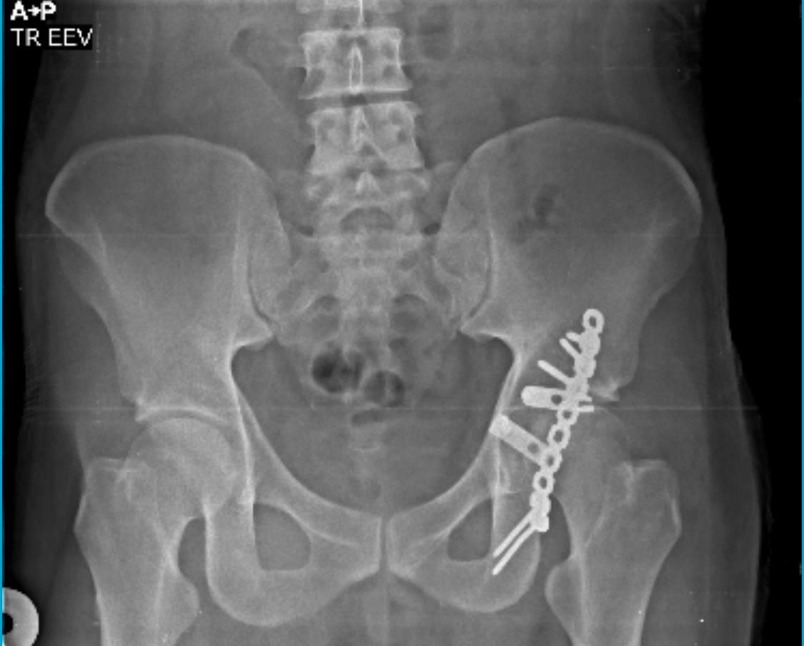 Abraham Gutiérrez Ávila-3