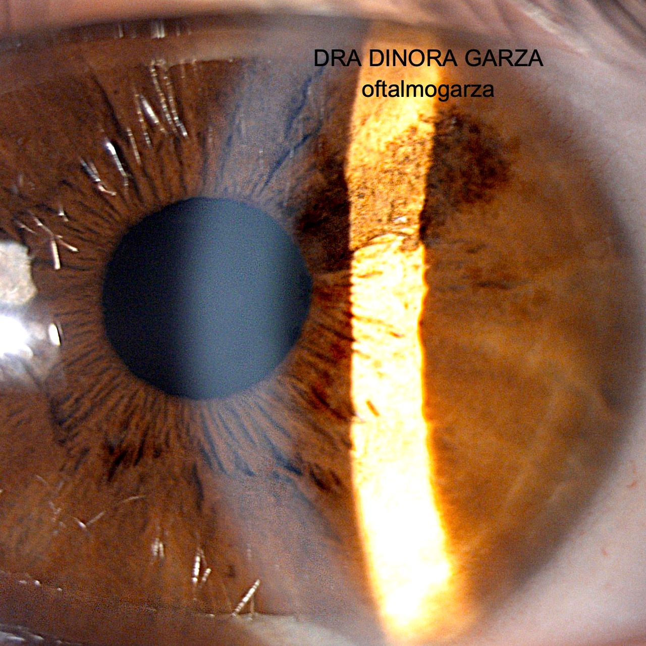 Dinora Garza Leal-53