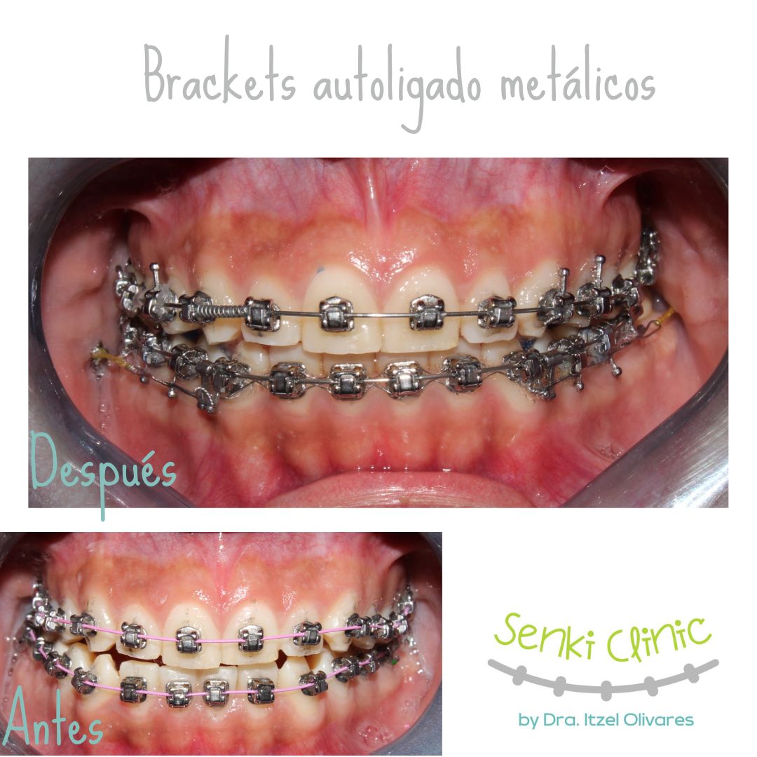 Itzel Olivares Lara-13