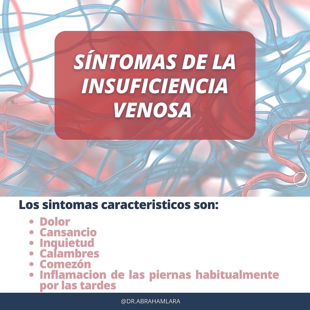 Miguel Abraham Lara Perez-38