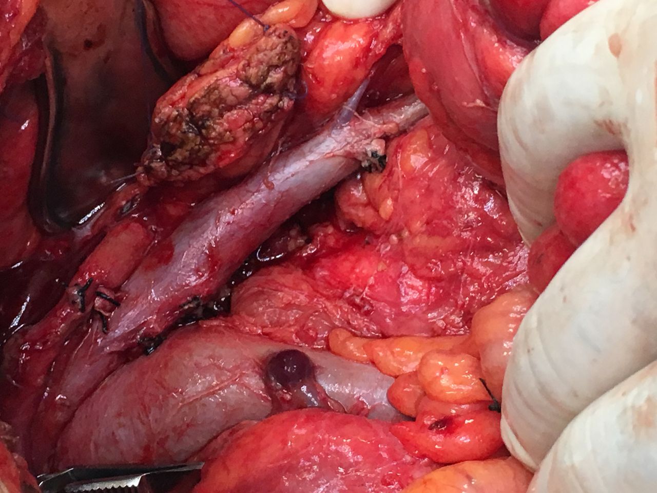 César Espejel Valdés-31