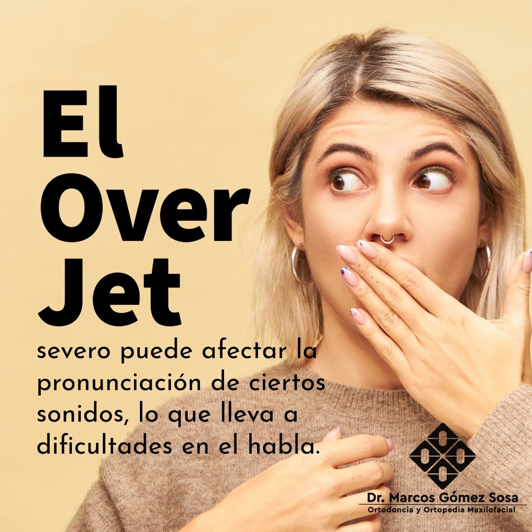 Marcos Gómez Sosa-33