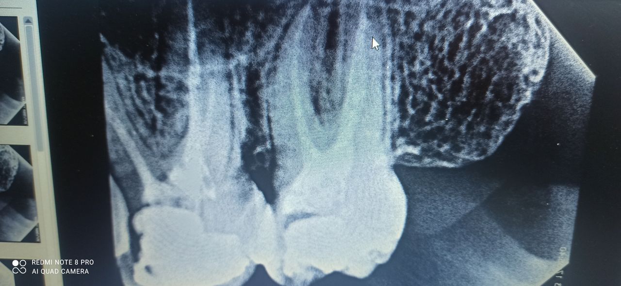 Oscar Cortez Perez-12