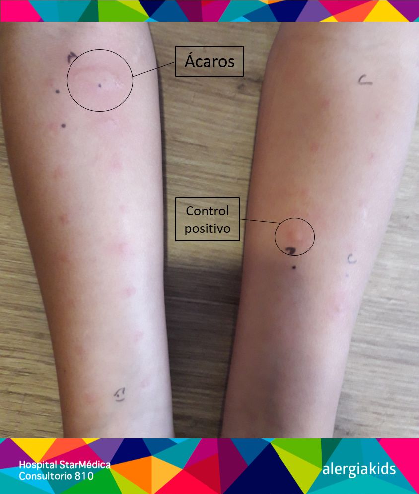 Herberth Pérez Avilés-4