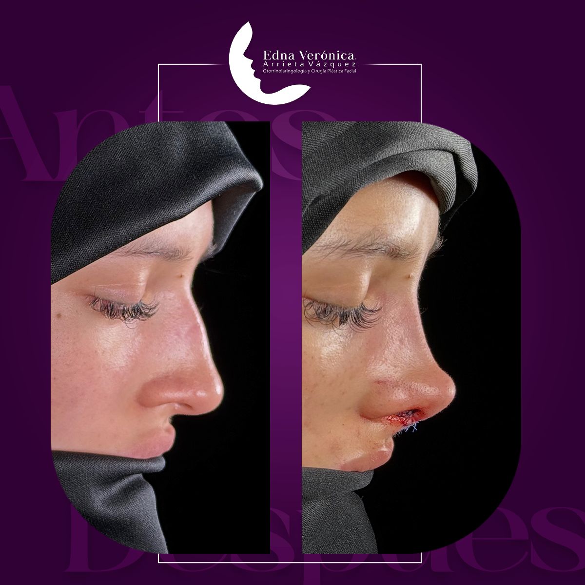 Edna Verónica Arrieta Vázquez-2