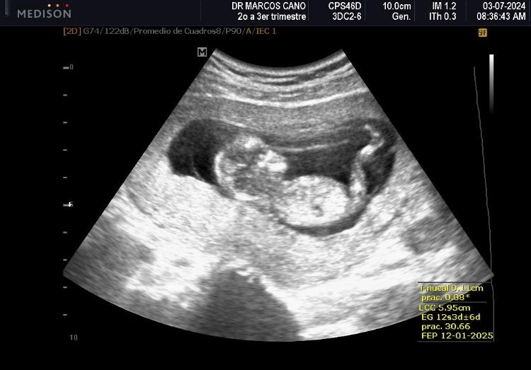 Marcos Javier Cano Luna-5