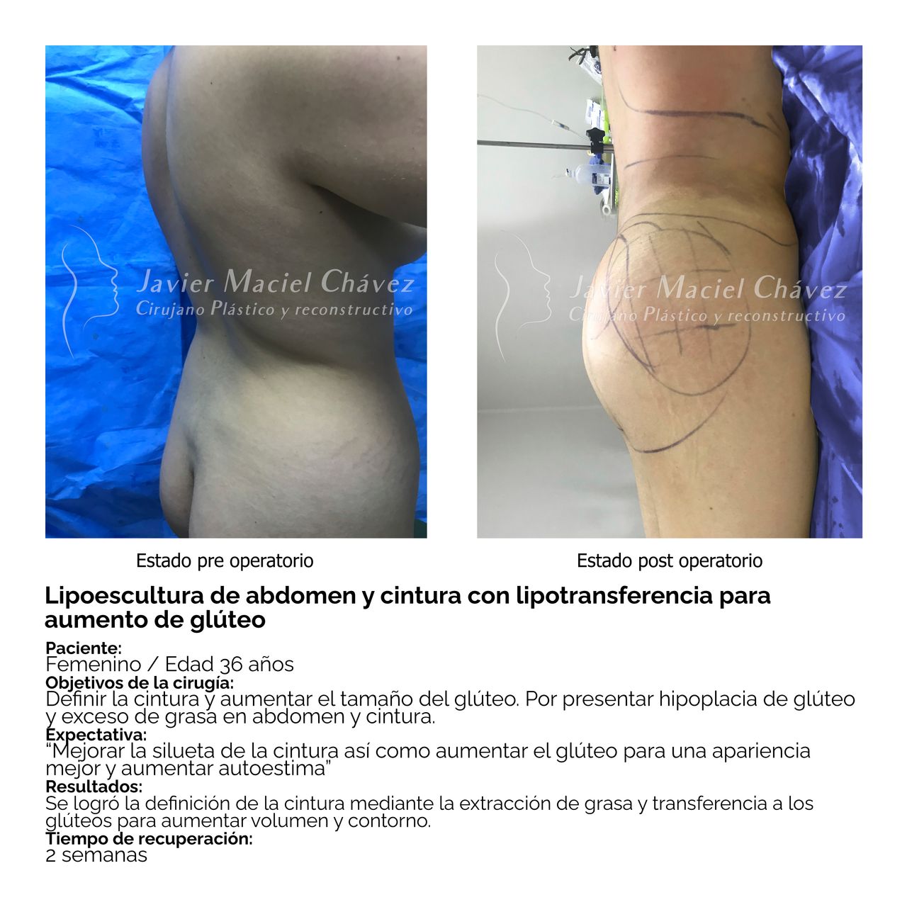 Javier Maciel Chávez-30