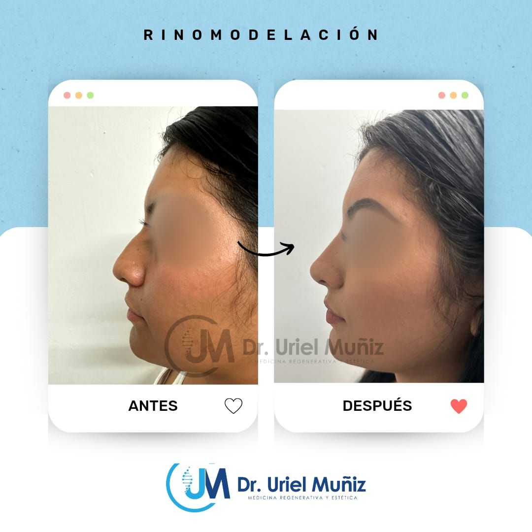 Teófilo Uriel Muñiz Chávez-44