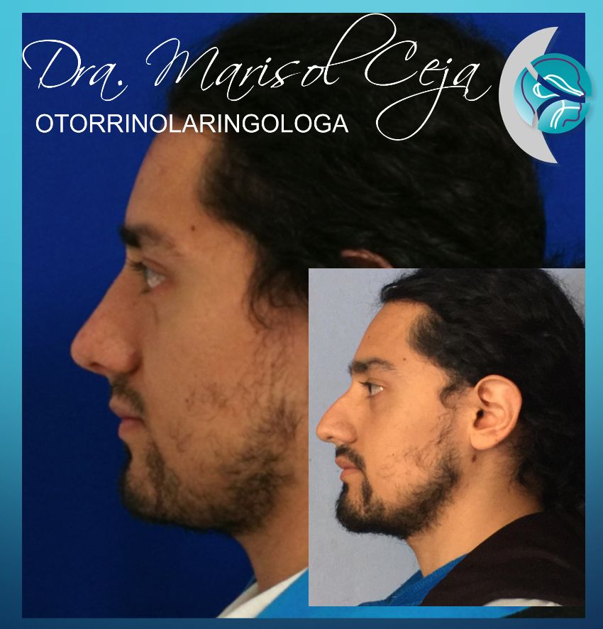 Marisol Ceja Zepeda-23