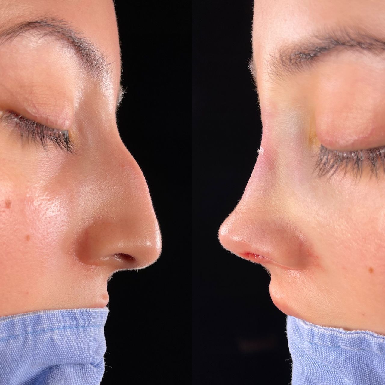 Angel Castro Urquizo-177