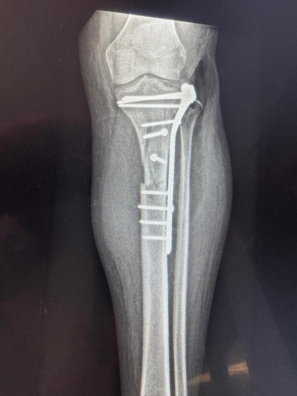 Juan Pedro Martínez Ávila-5