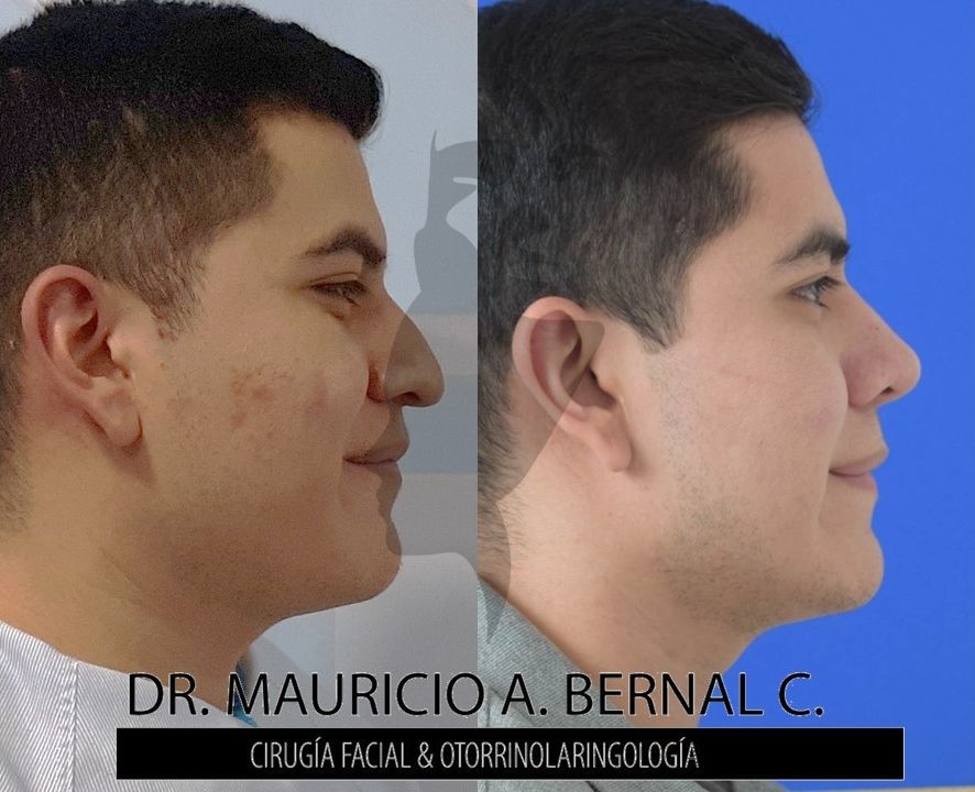 Mauricio Alejandro Bernal Carreon-27