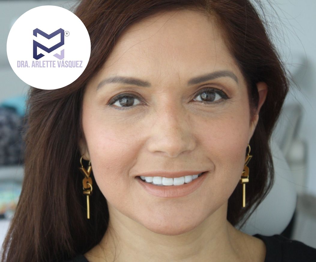 Arlette Vásquez Garza-7