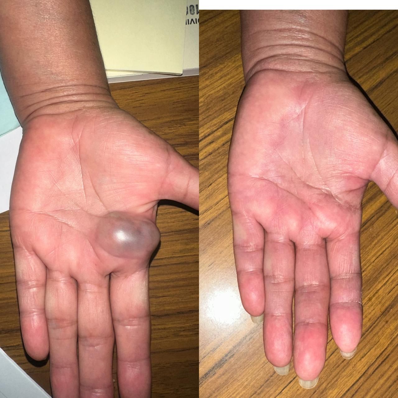 Jhonatan López González-60