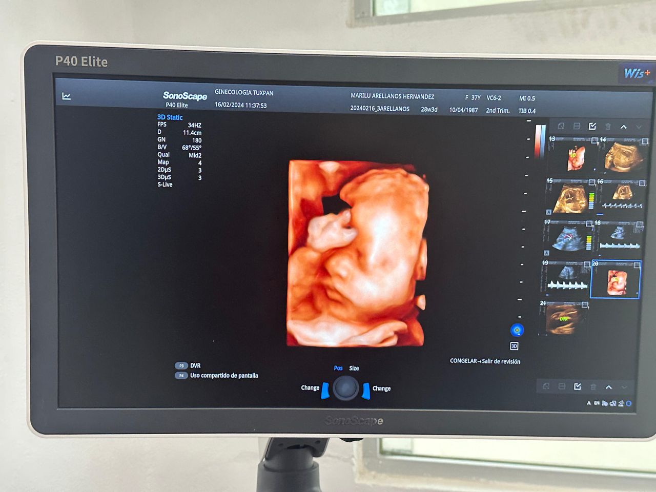 Abimelec Reyes Durán-8