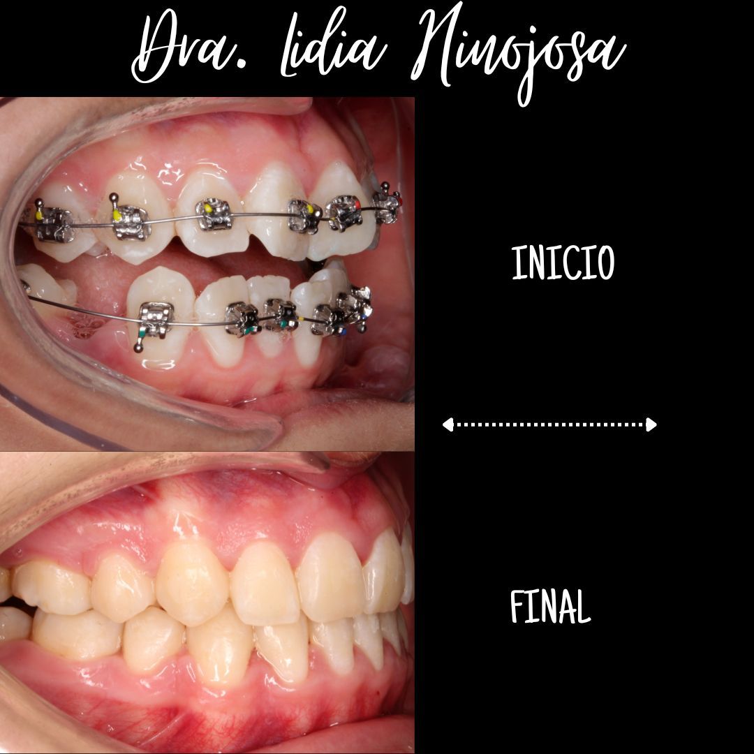 Lidia Abigail Hinojosa Arellanes-33