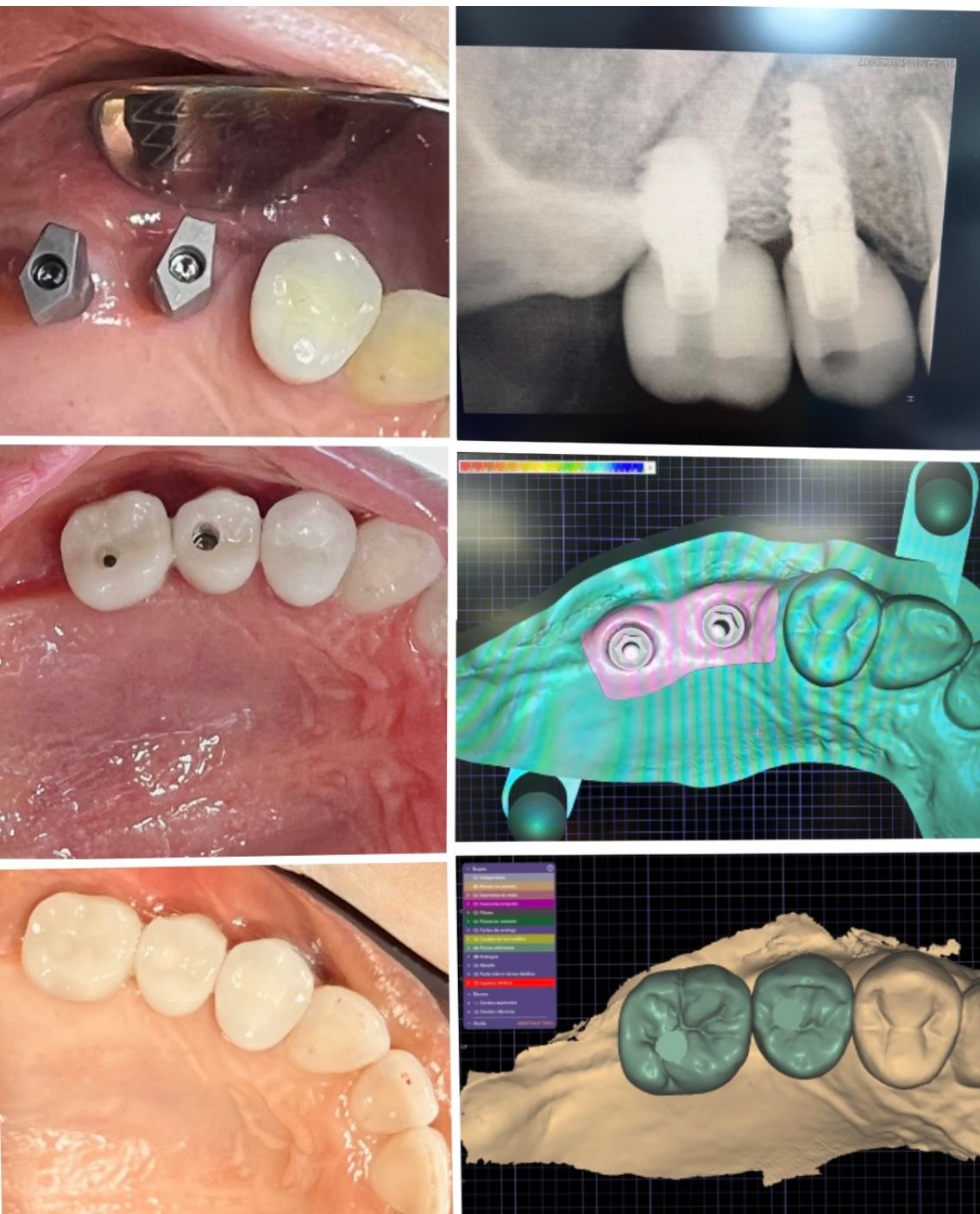Ireri García Santana-5