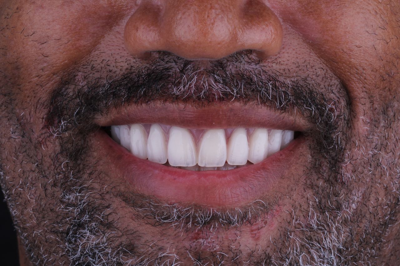 Arturo Mendez Valencia-4