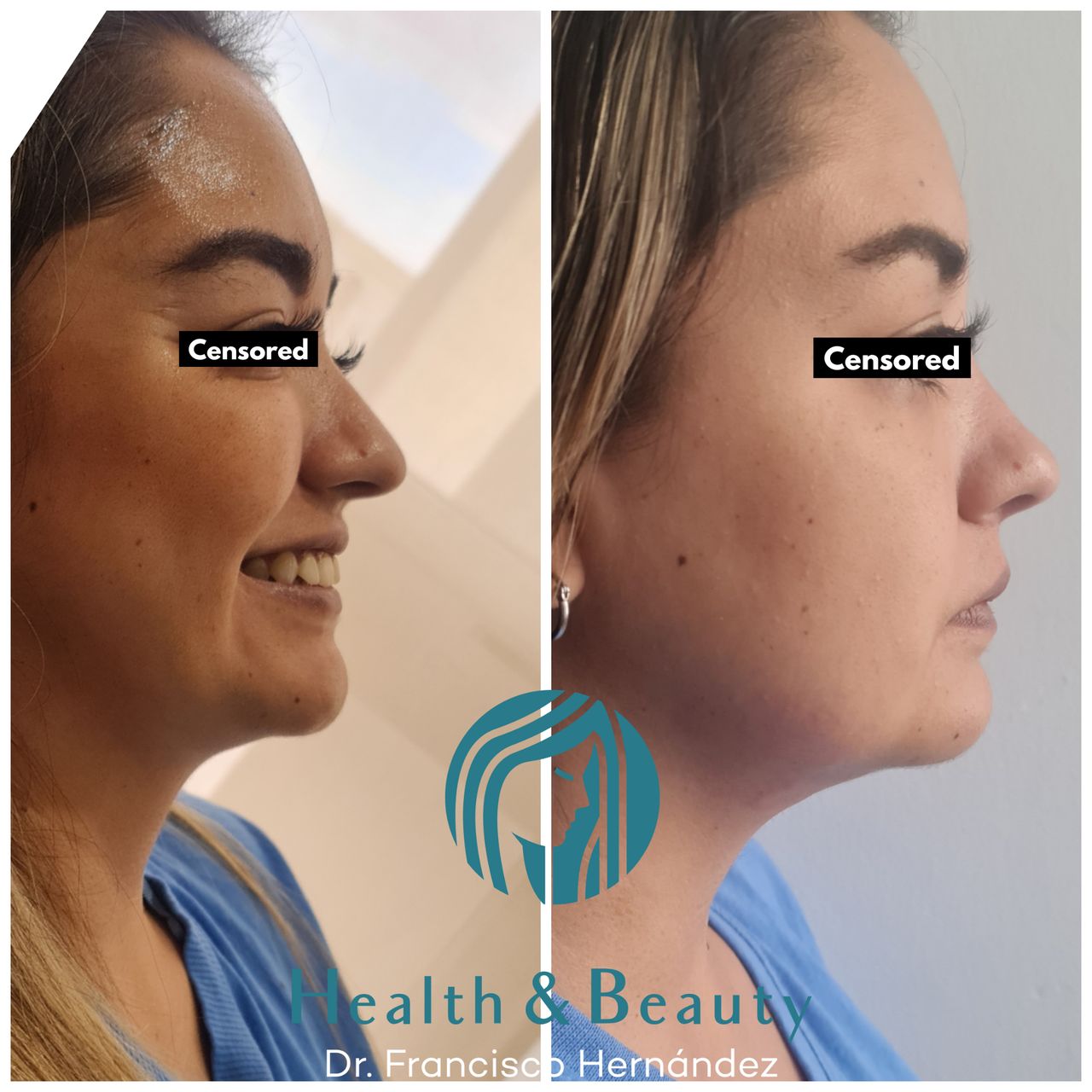 Francisco Hernández Gómez Crespo-103