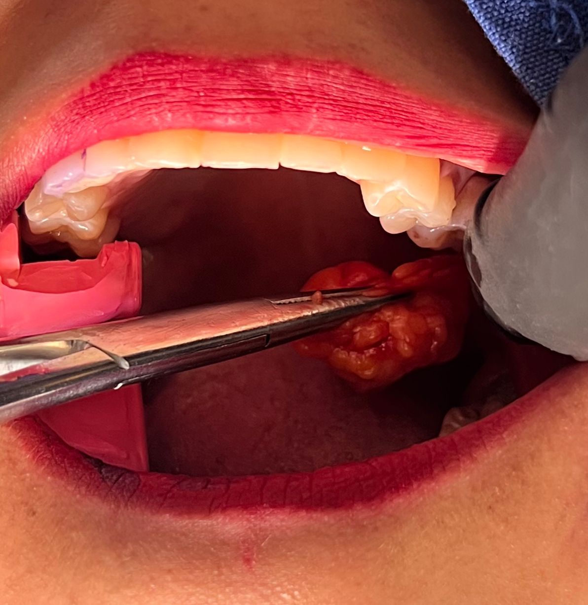 Jair Contreras García-0