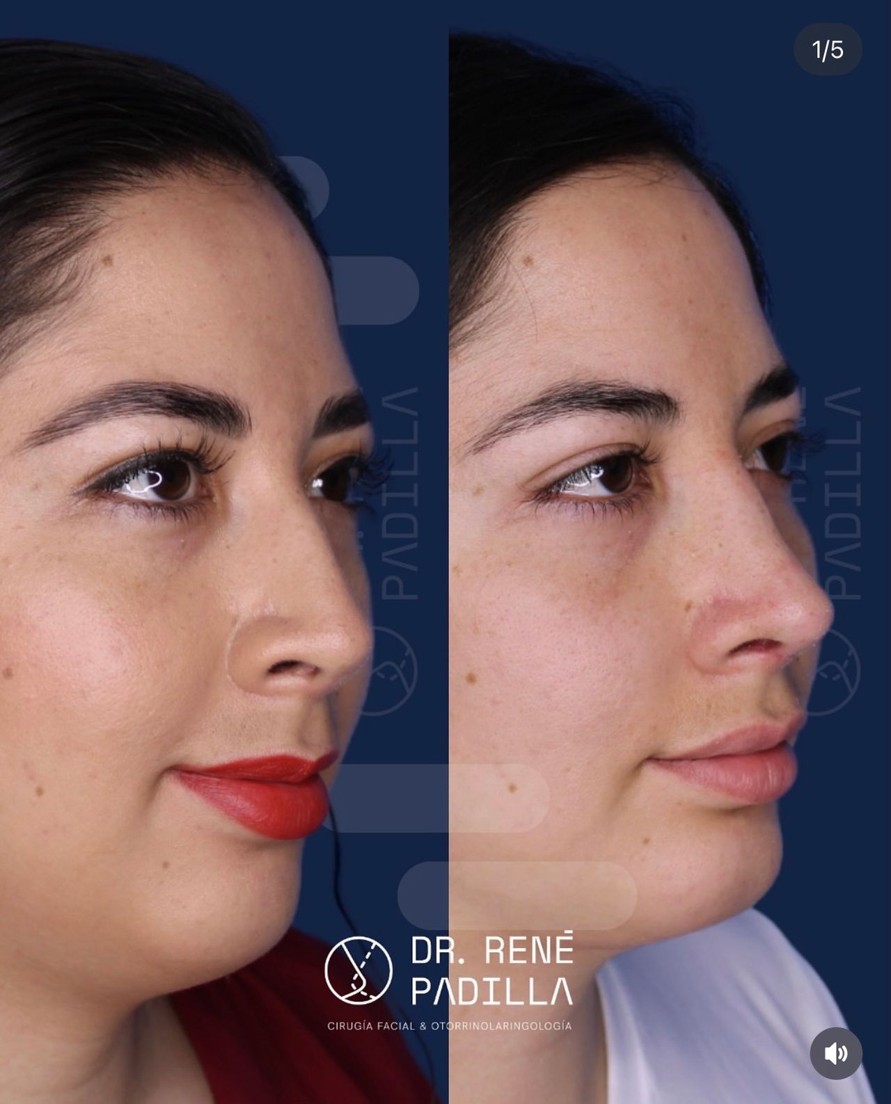 René Emmanuel Padilla López-13