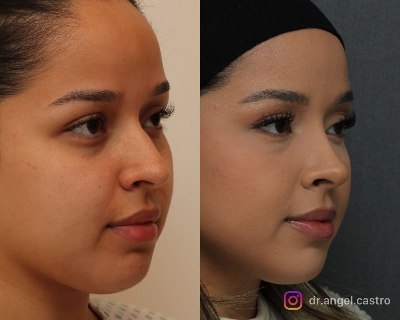 Angel Castro Urquizo-78