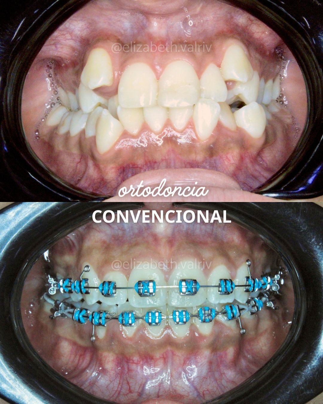 Elizabeth Valenzuela Rivera-8