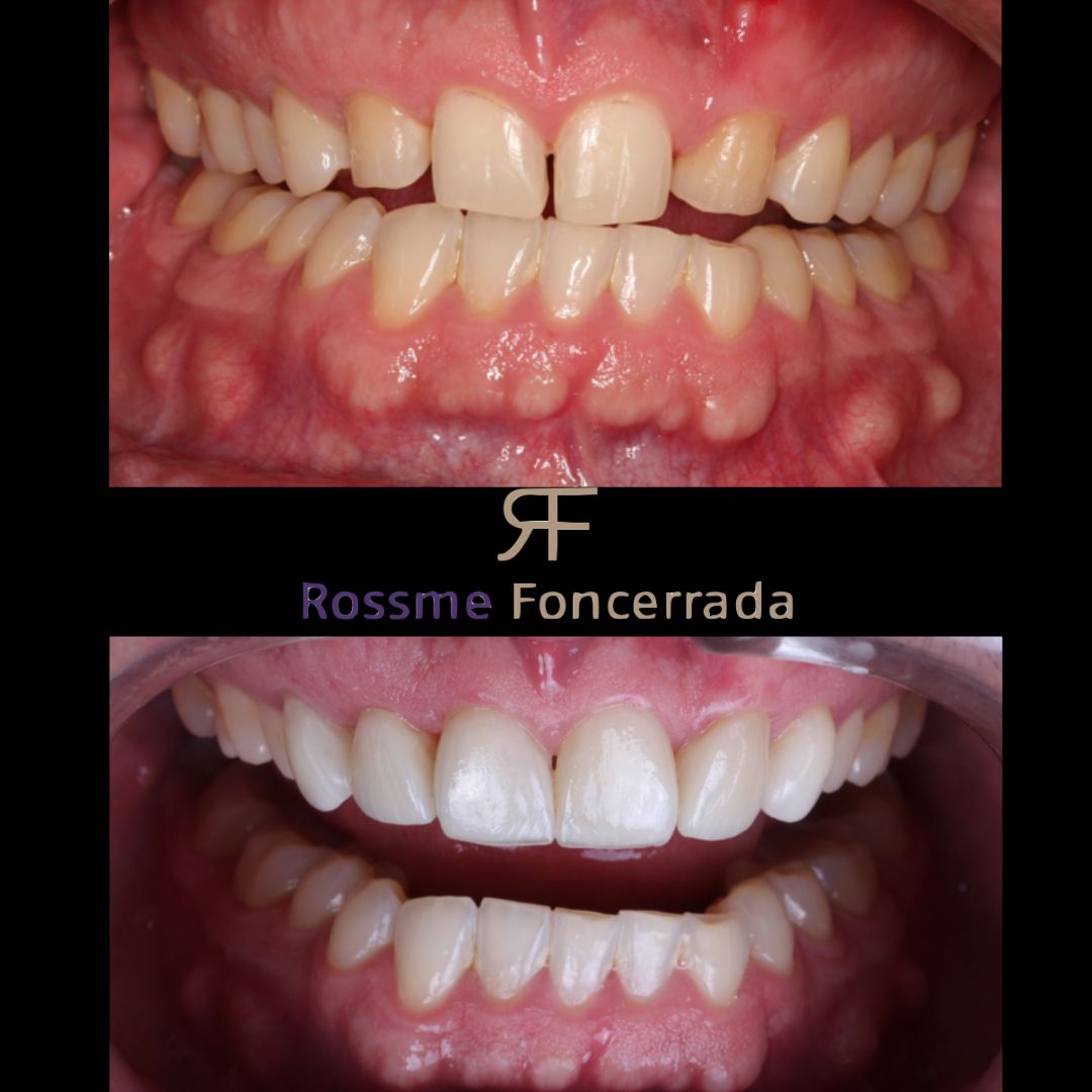 Rossme Foncerrada-13