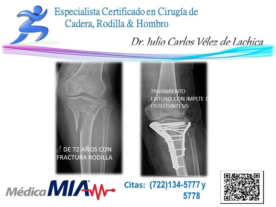 Julio Carlos Vélez De Lachica-36