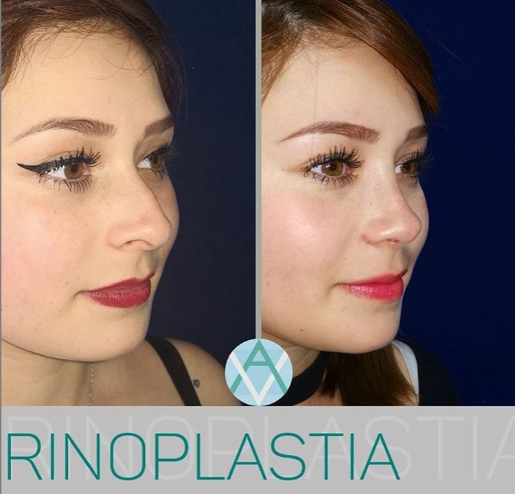 Alfonso Villaseñor Herrero-14