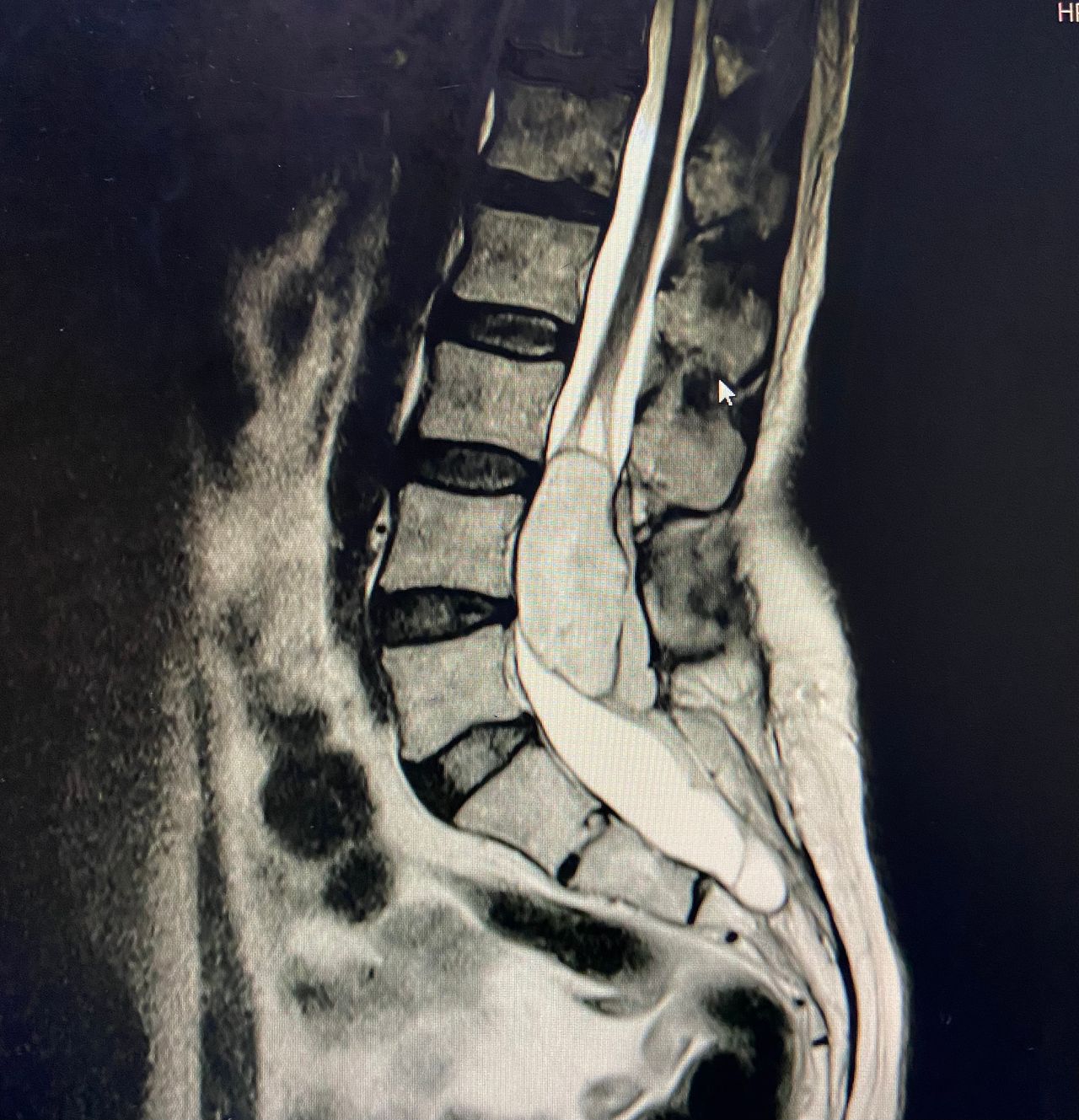 Bardo Grimaldo Hurtado-1