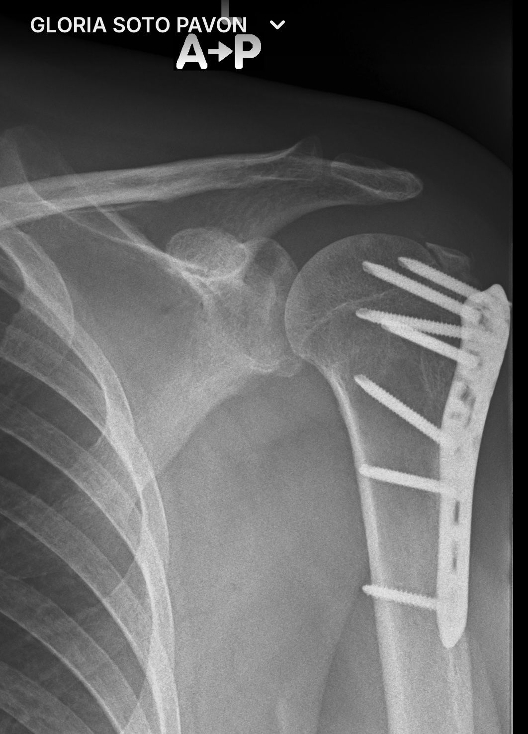 Alejandro Martínez Ramírez-45