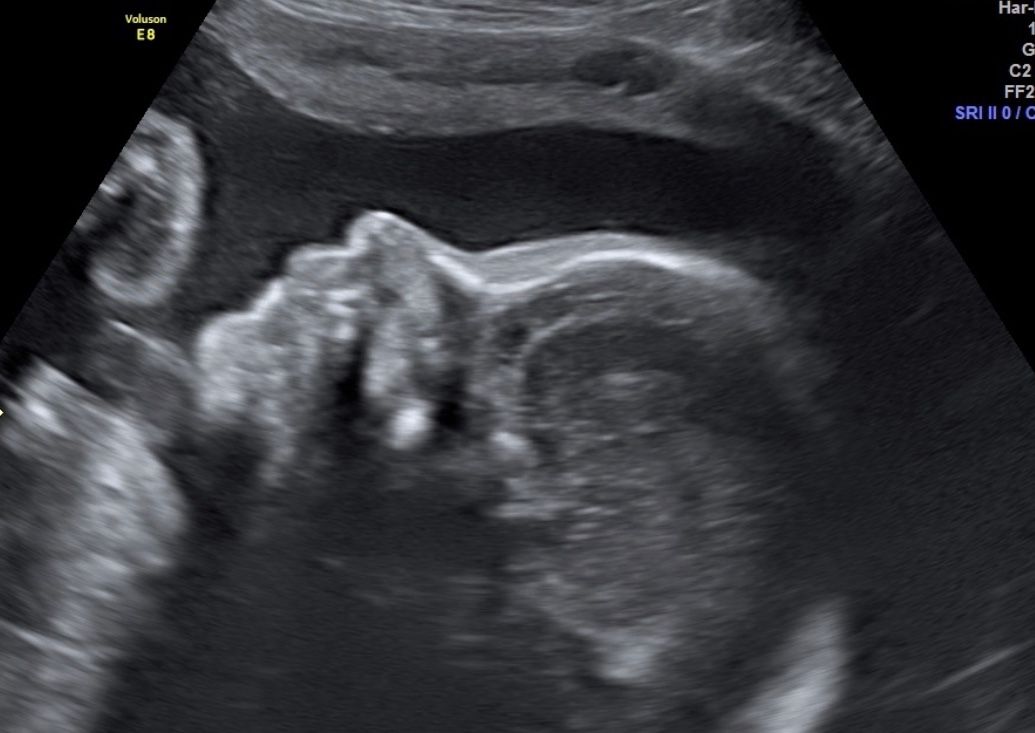 Blanca Esthela Rosales De La Garza-2