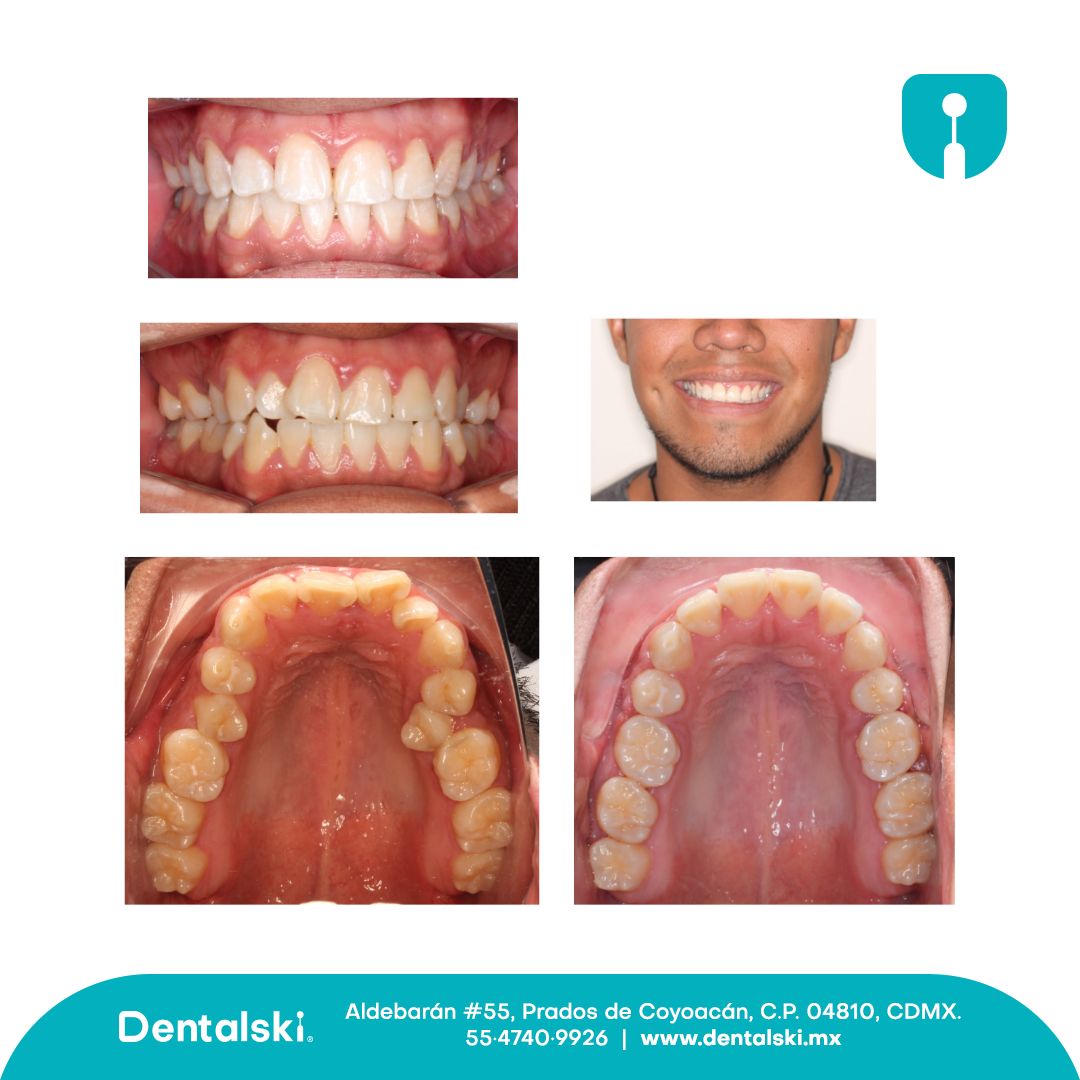 Hugo Gael Méndez Pérez-3