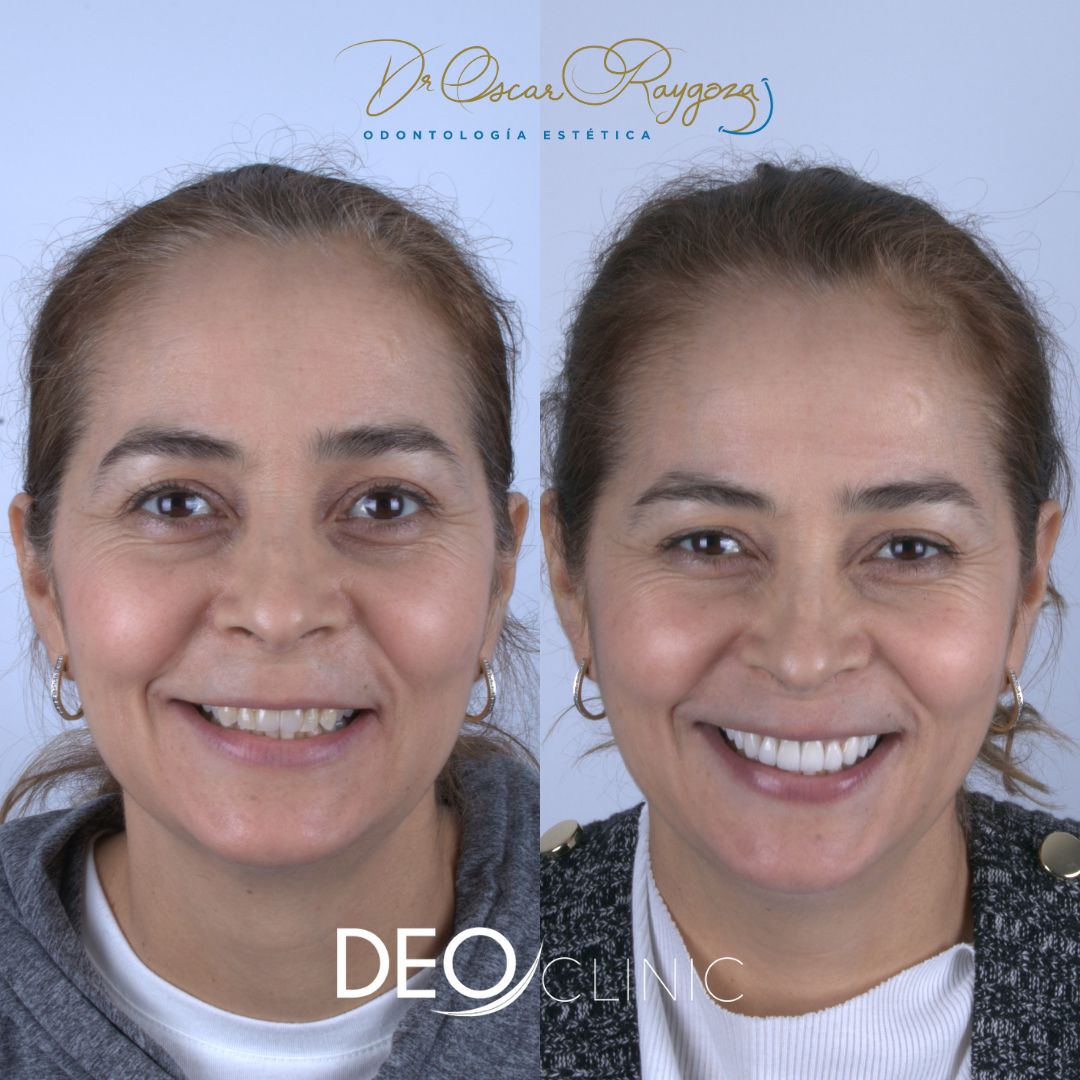 Oscar Raygoza Carrillo-17