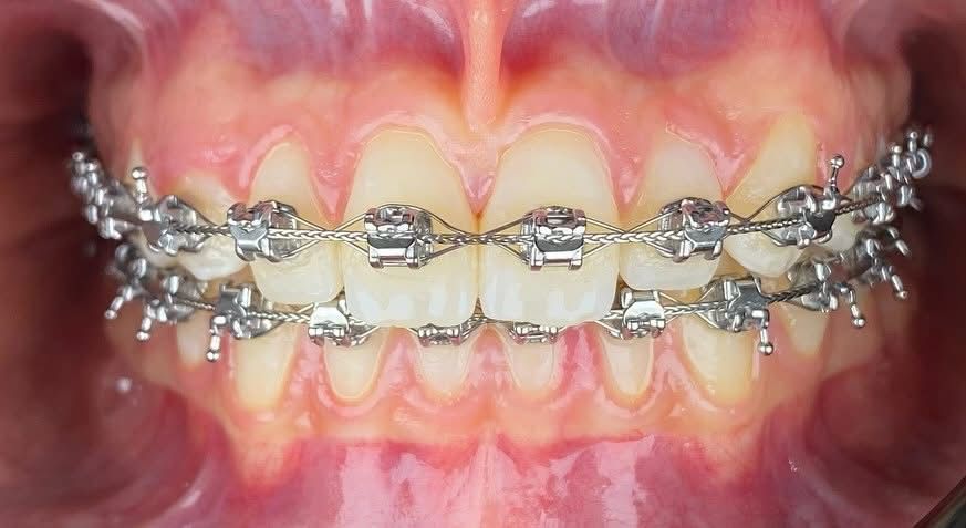 Martha Alicia Ceniceros Betancourt-9