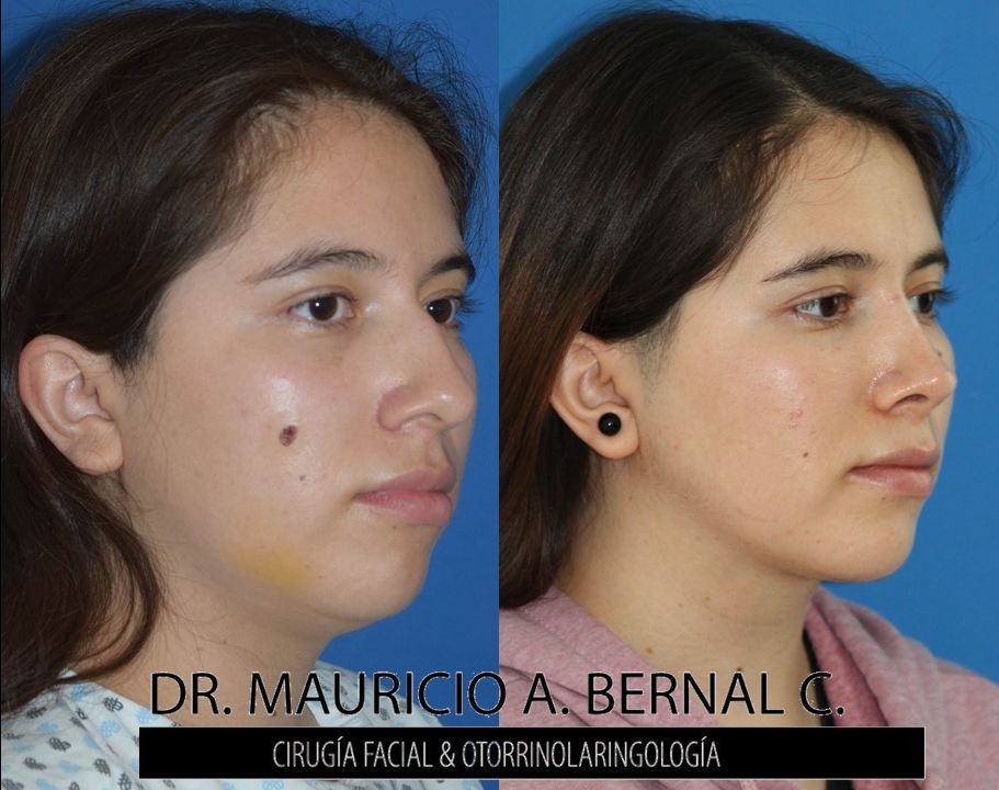 Mauricio Alejandro Bernal Carreon-32