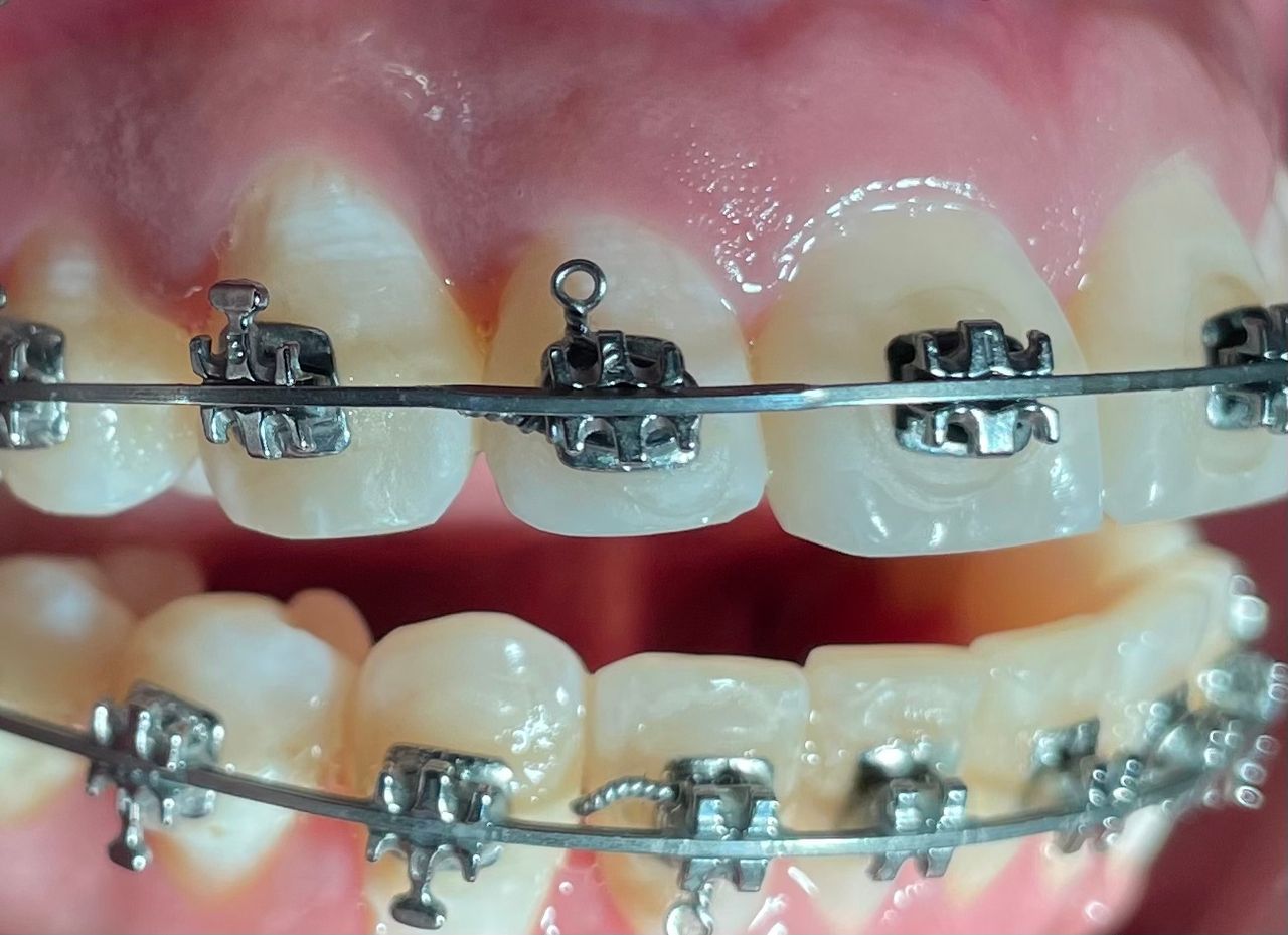 Luis Ernesto Calva Valdez-16