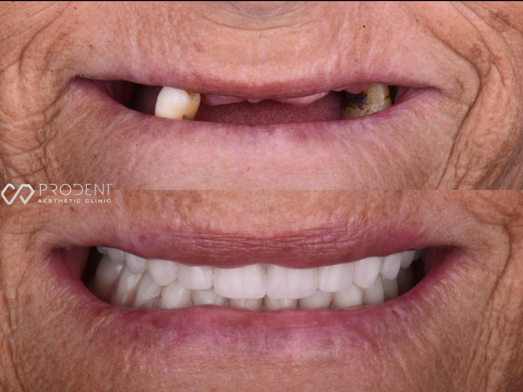 Ulises Pérez Murillo-66