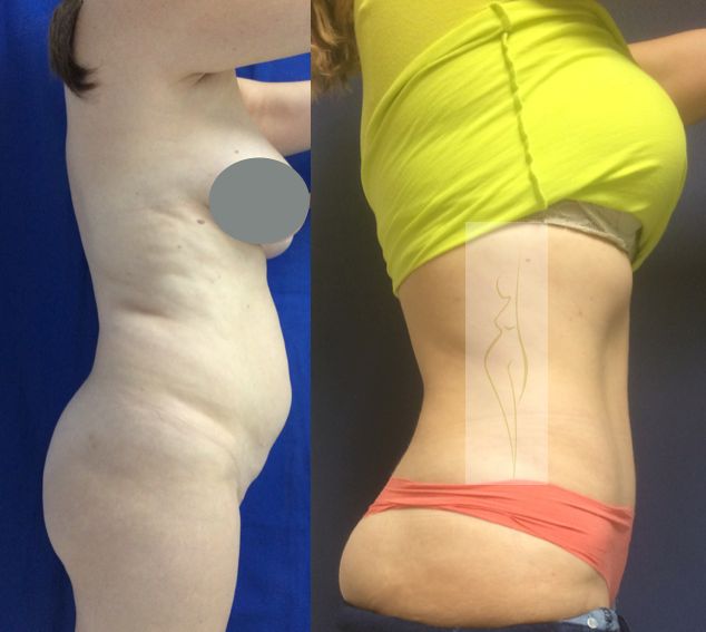 Rubén Nieto Balcázar-10