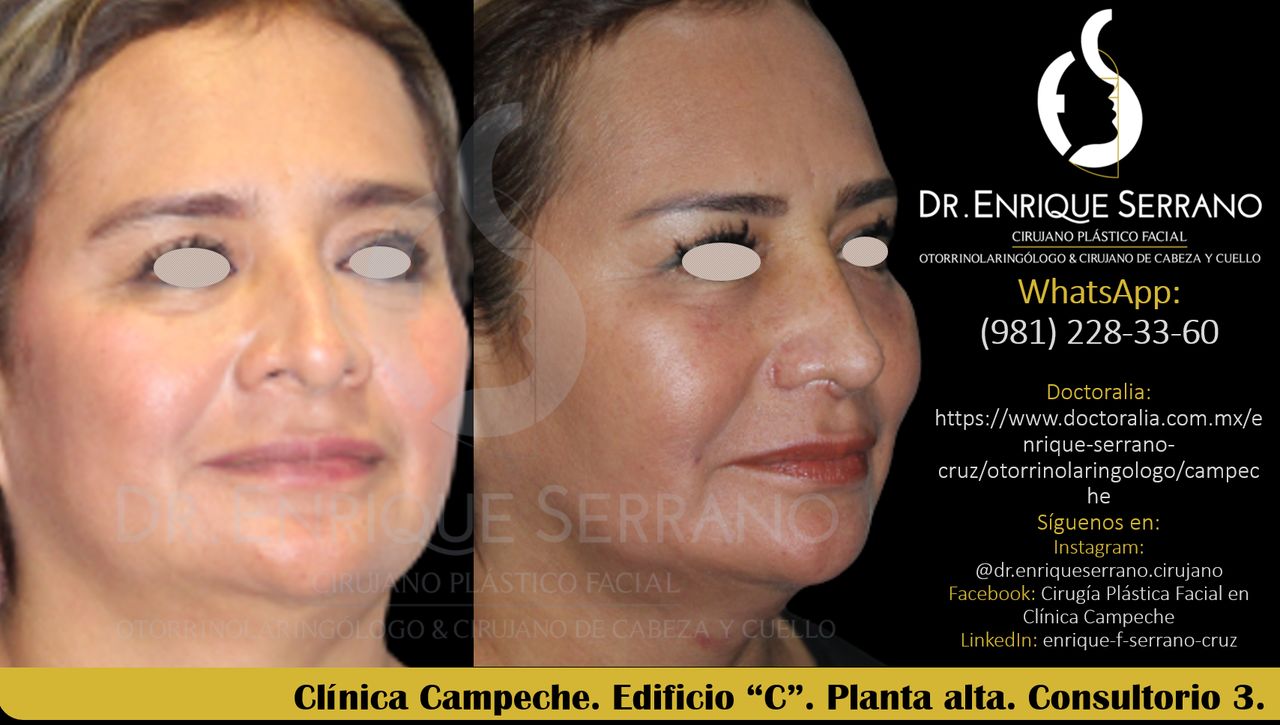 Enrique Serrano Cruz-60