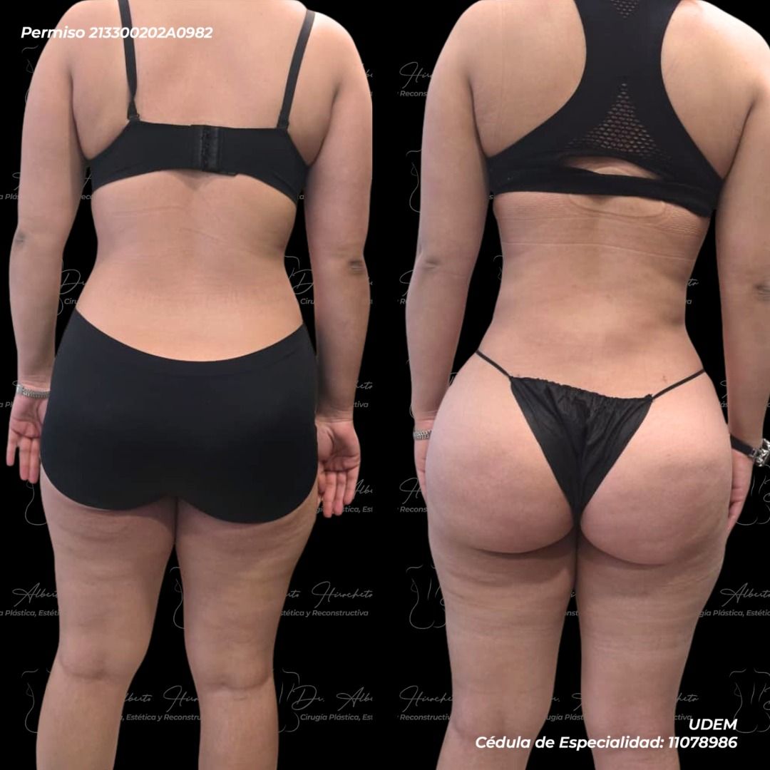 Alberto Hiracheta Torres-31