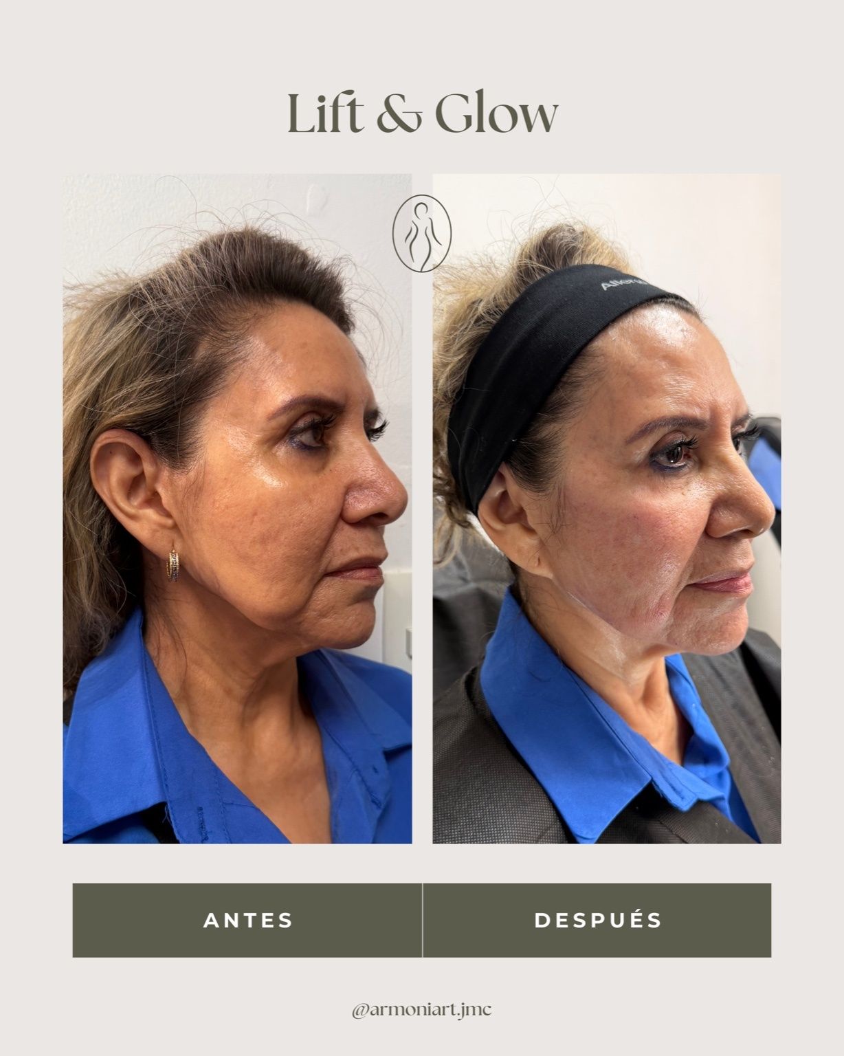 Josehlyn Martínez Carrillo-10