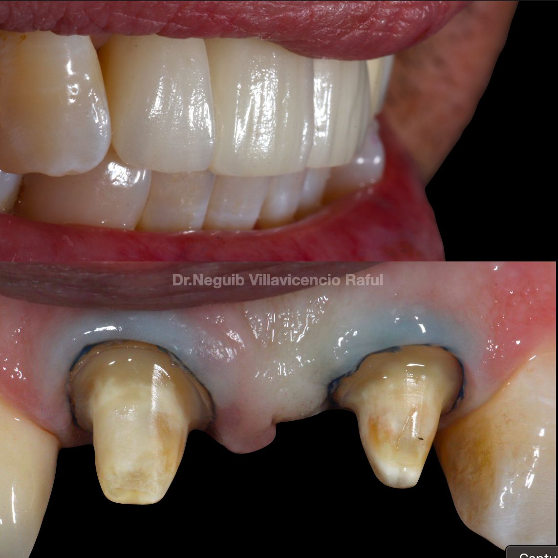 Neguib Villavicencio Raful-57