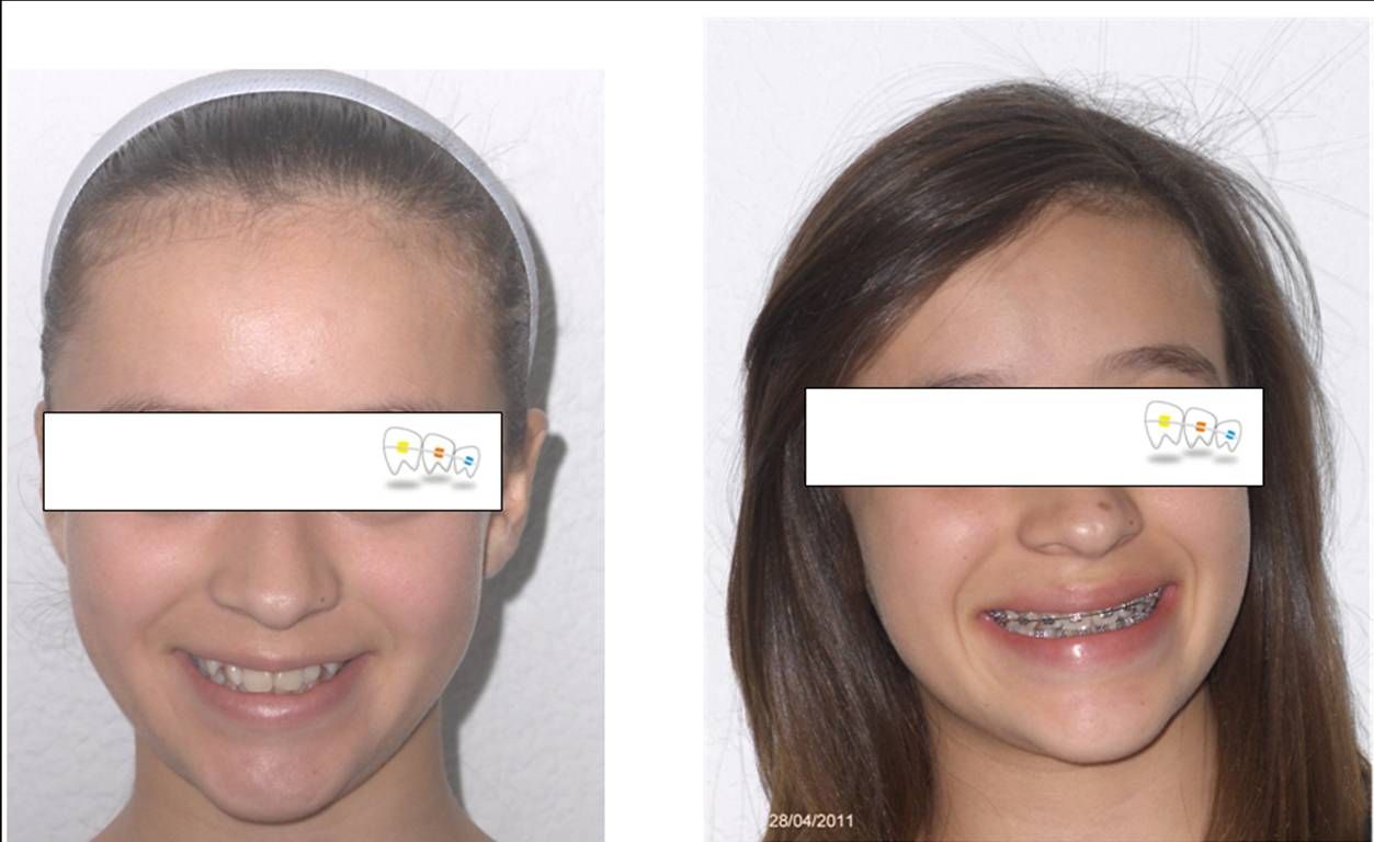 Iris Ocampo Fonseca-10